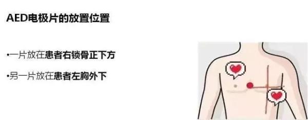 When the body shows the following six signals, it is necessary to be highly alert to sudden death.